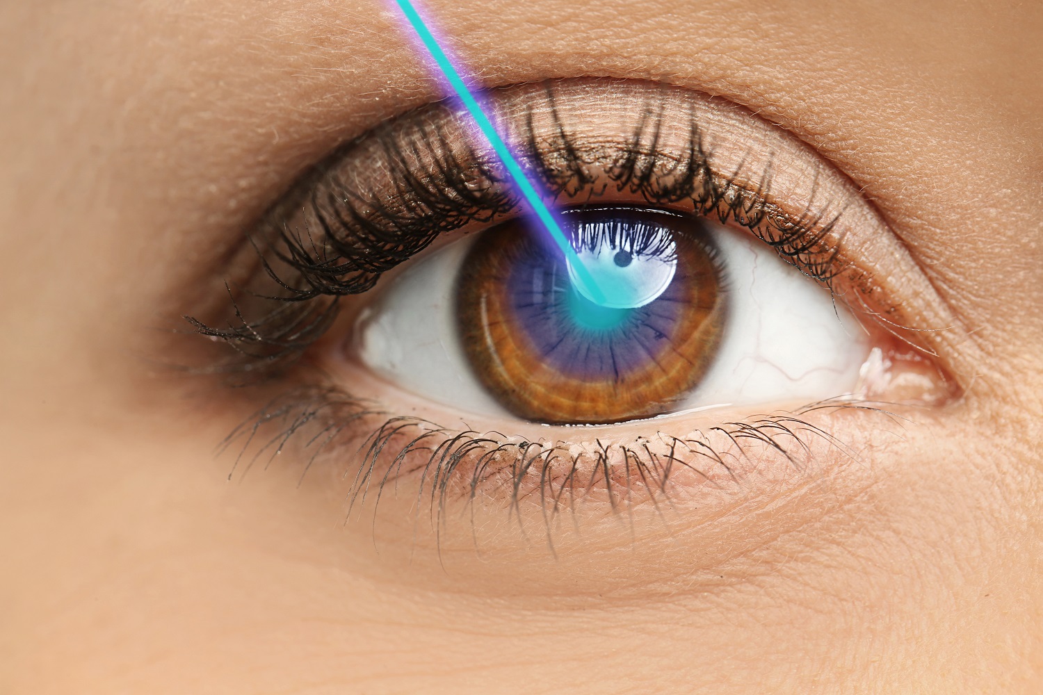 LASIK Eye Surgery in Karnal: What You Need to Know - Learn Insider