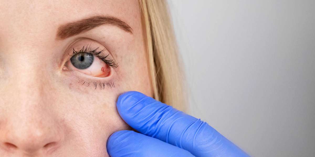 Don't Let Eye Infections Go Untreated: How to find the best eye Clinic near You