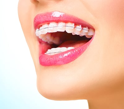 Why An Orthodontist Is a Right Person For Your Orthodontic Treatment?: orthodontic1 — LiveJournal