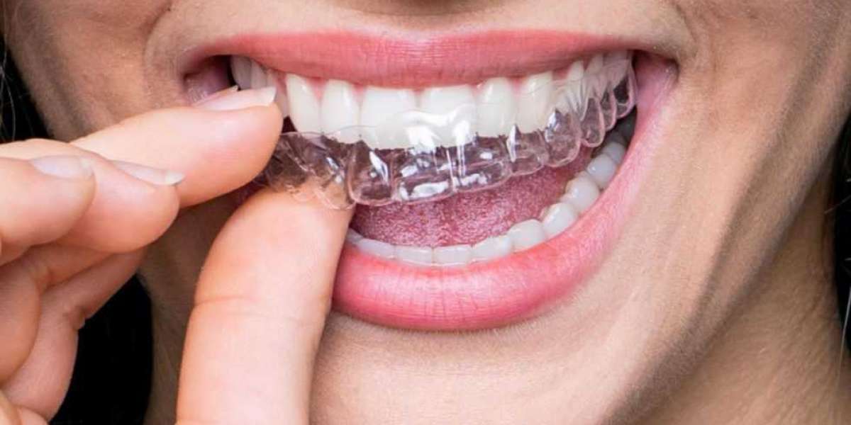 Global Transparent Dental Materials Market growth projection to 13.80% CAGR through 2030