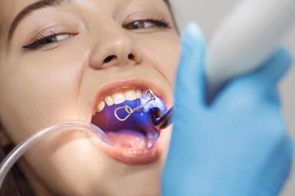 Smile Makeovers: How a Cosmetic Dentist Can Transform Your Teeth | Pearltrees