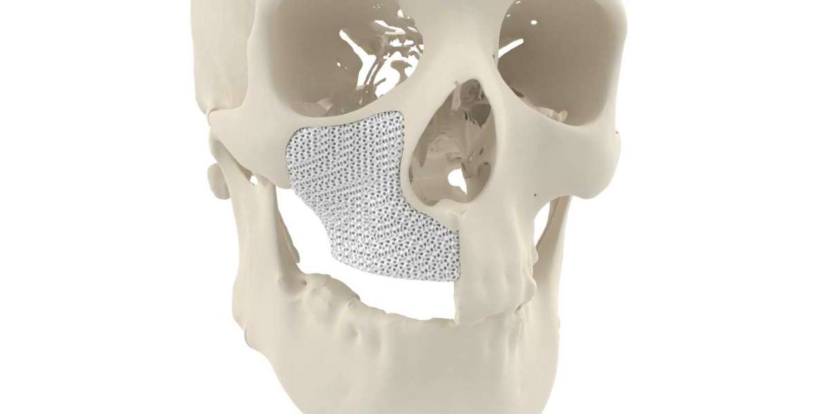 3D Printed Bones Market size is expected to grow at a CAGR of 4.7% by 2033