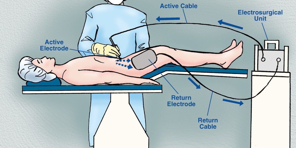 Electrosurgery Market Size, Share, Growth and Market 2022 Forecast to 2032.