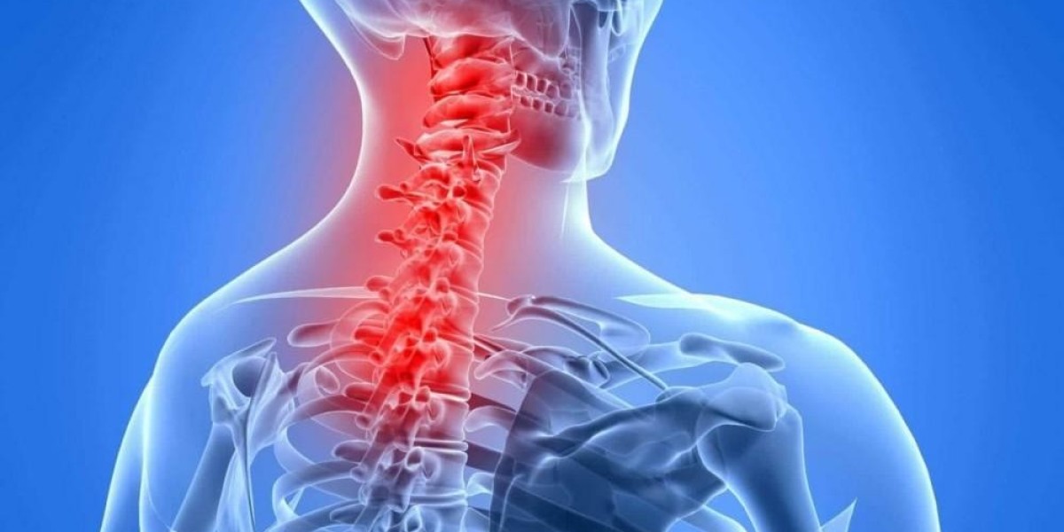 NECK PAIN: SYMPTOMS AND CAUSES