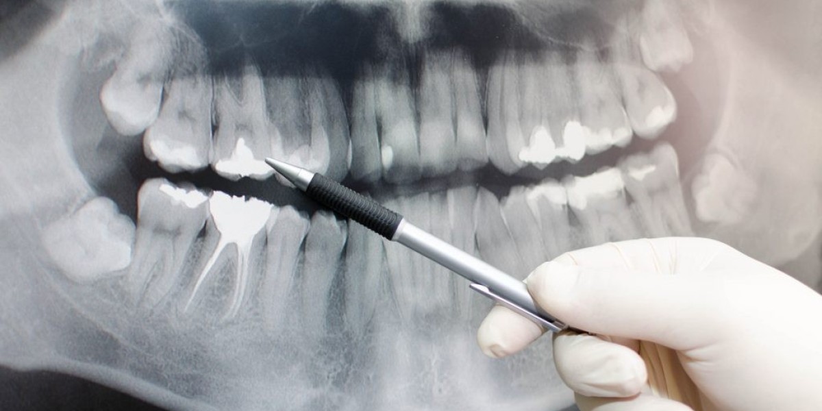 Global Dental Radiography Market Size, Share, Trend and Forecast 2021–2030.