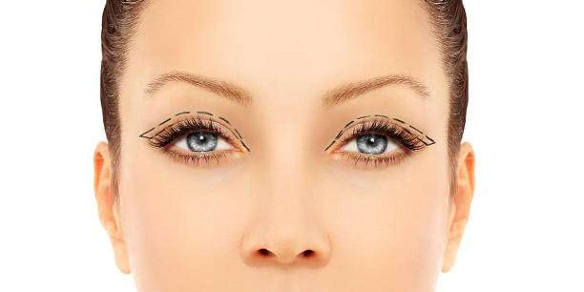 Asian Eyelid Surgery: Specialized Procedures in Abu Dhabi