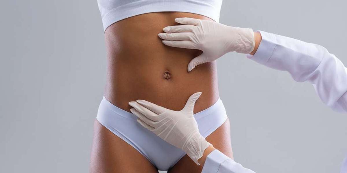 Maintaining Results: Lifestyle Tips After Tummy Tuck Surgery