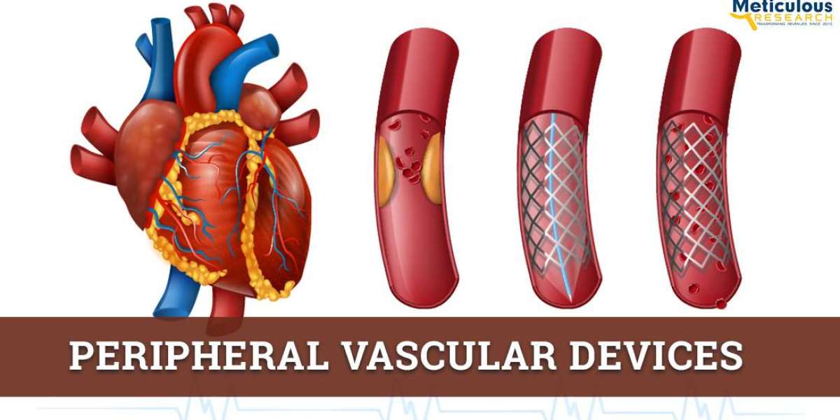TOP 10 COMPANIES IN PERIPHERAL VASCULAR DEVICES MARKET