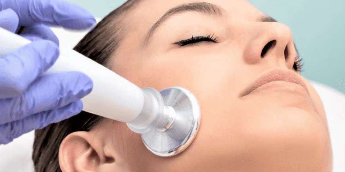 The Latest Advancements in Laser Acne Scar Therapy