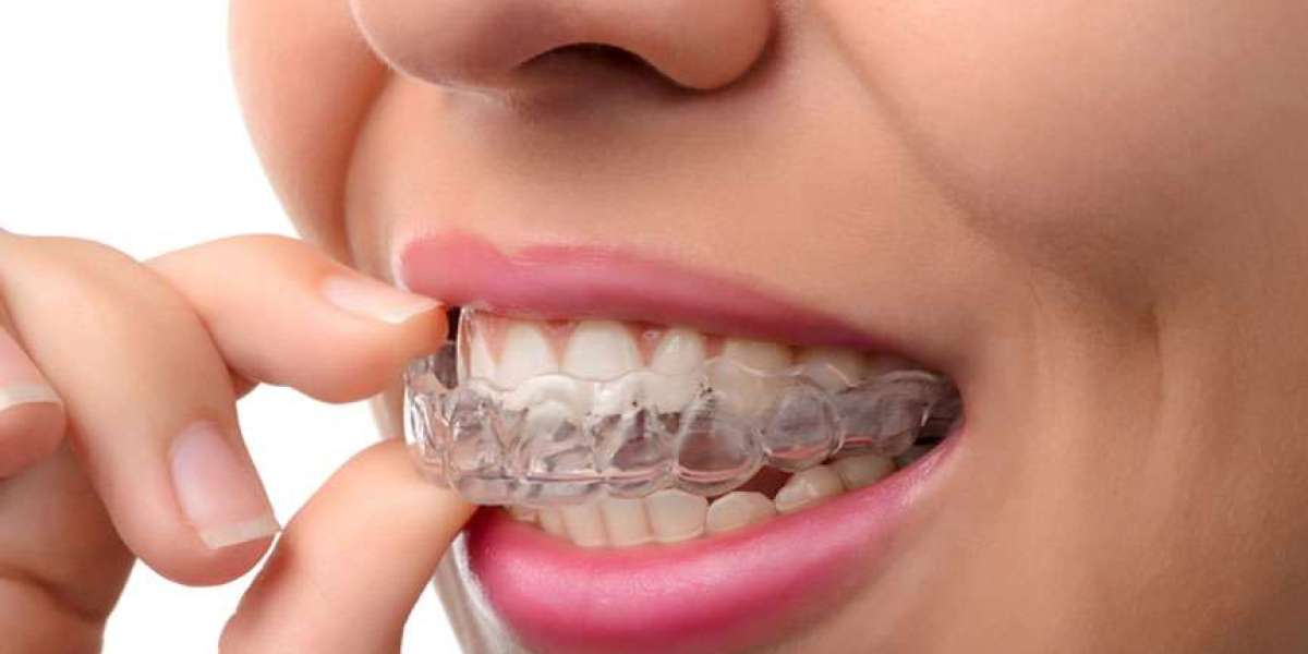 Beyond the Metal: Choosing Invisalign for Orthodontic Excellence