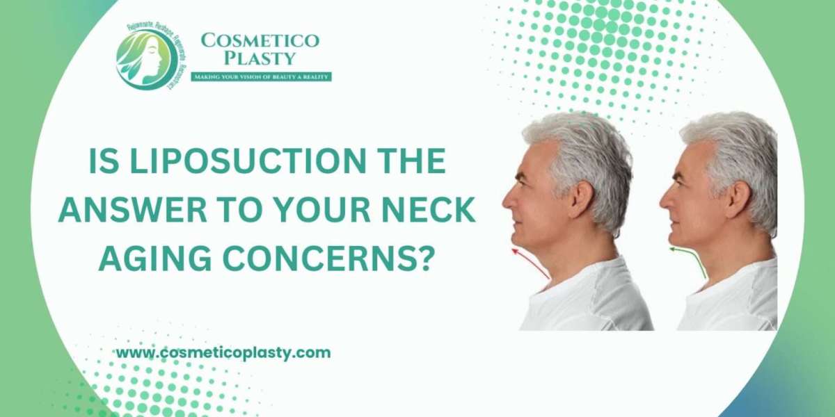 Is Liposuction the Answer to Your Neck Aging Concerns?