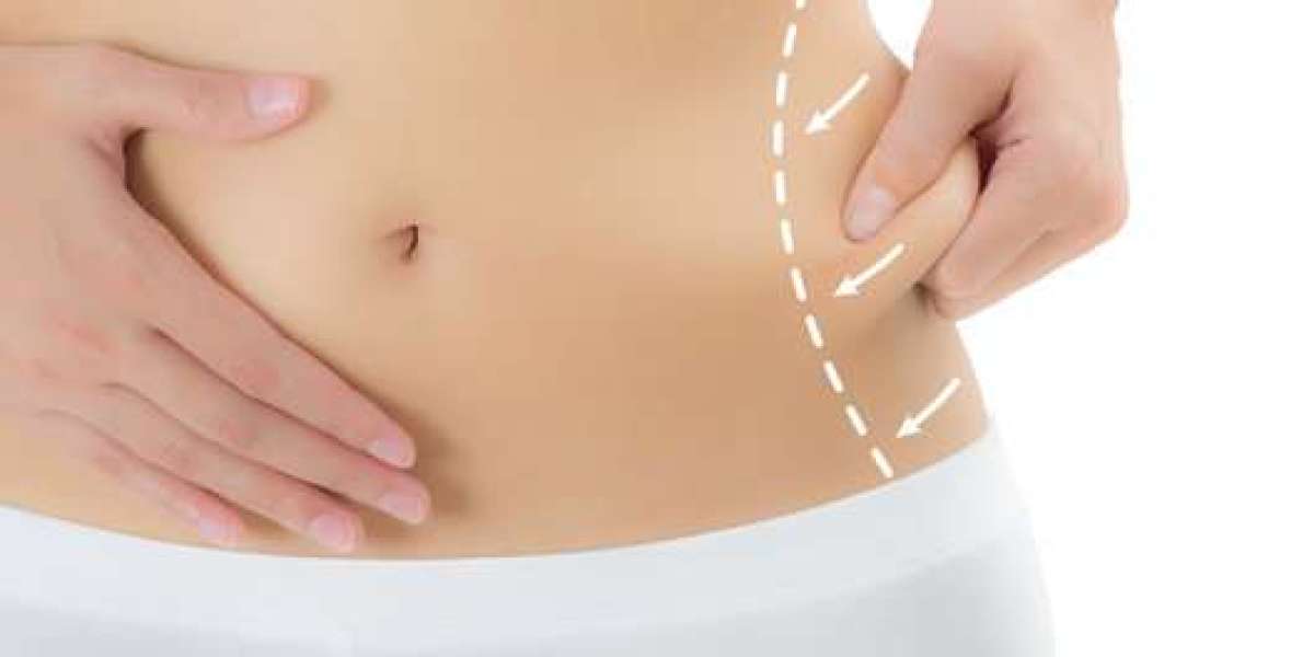 The Wonders of Fat Transfer for Breast Augmentation