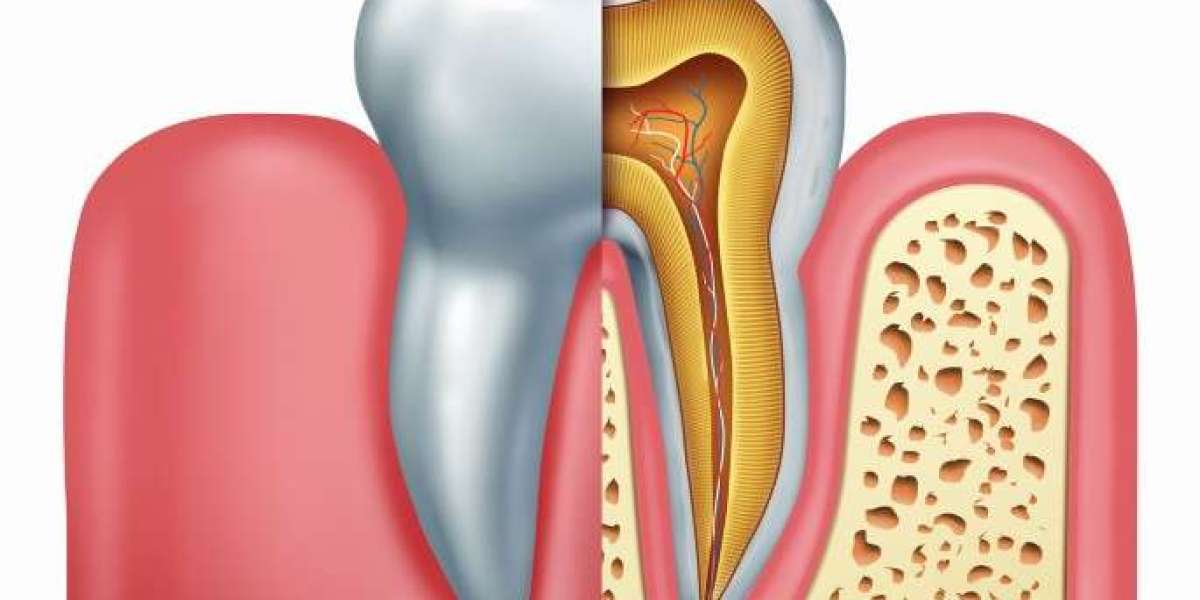 Cost of Root Canal Treatment: Factors and Considerations