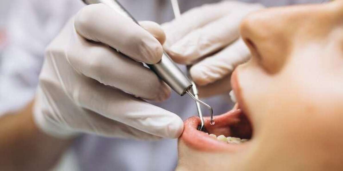5 Reasons Why You Should Never Skip Your Dental Check-Up Preston