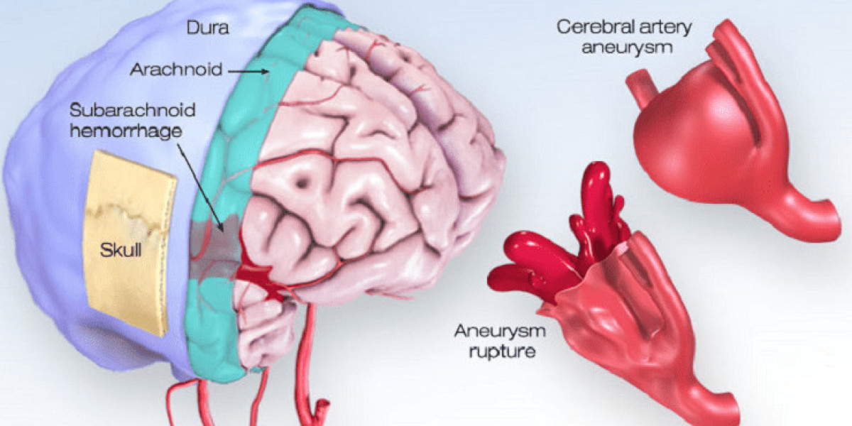 Unveiling Excellence Ahmedabad's Best Neurosurgeon Doctors