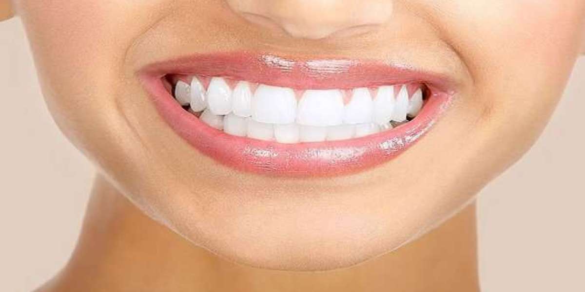 Achieve Whiter Teeth in Dubai