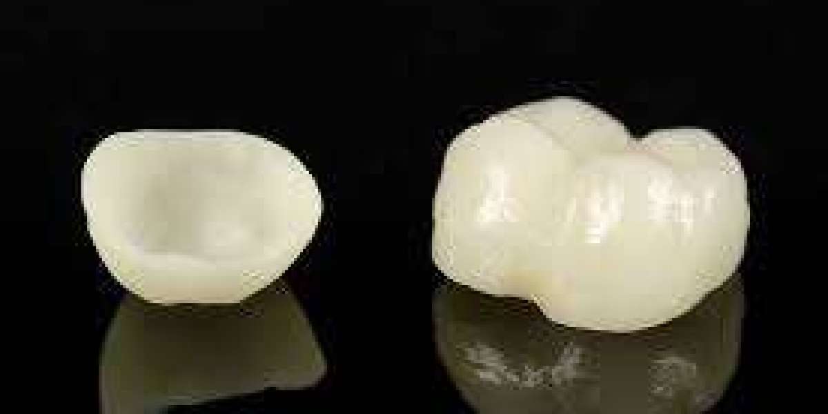 Ceramic Crowns and Gingival Health: A Holistic Approach to Dentistry