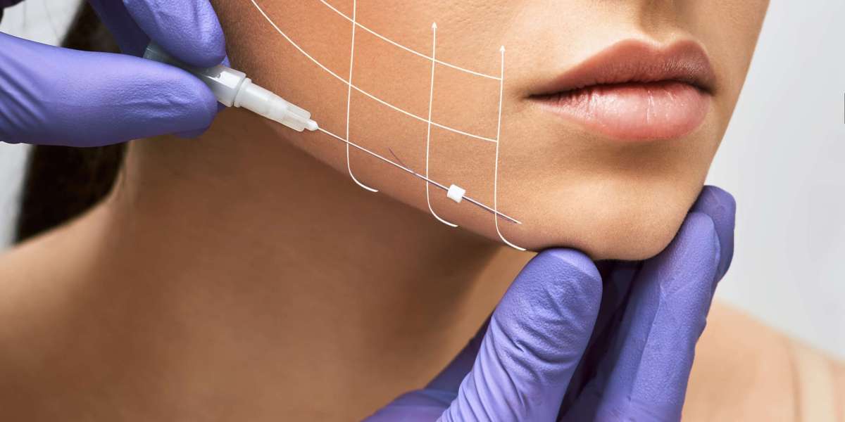 Threaded Transformation: Unveiling a New Era in Face Lift Treatments