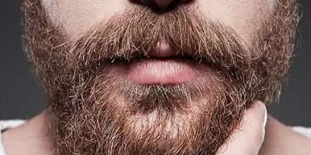 The Evolution of Beard Transplant Techniques: Past, Present, and Future