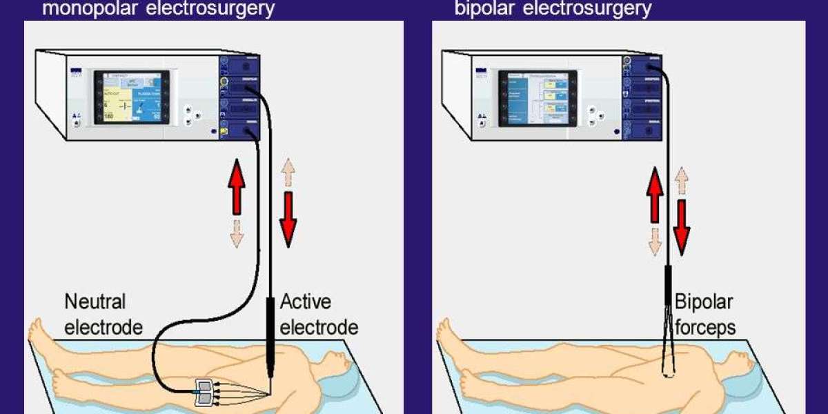 Monopolar Electrosurgery Market Trends, Size, Segment and Industry Growth by Forecast to 2030