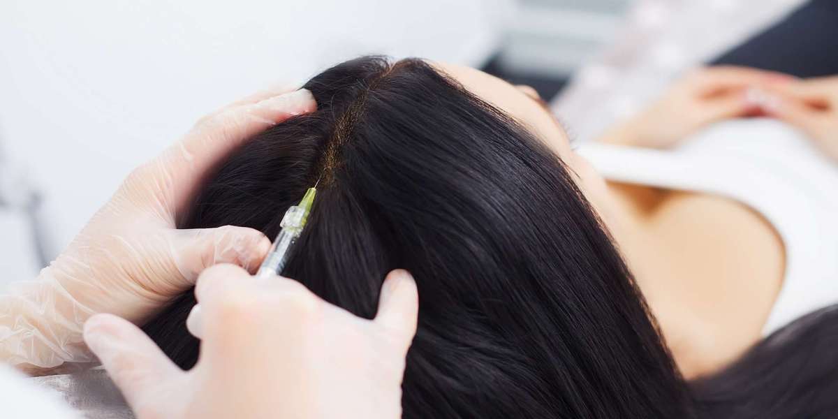 Transforming Lives: DHI Hair Implantation in Dubai