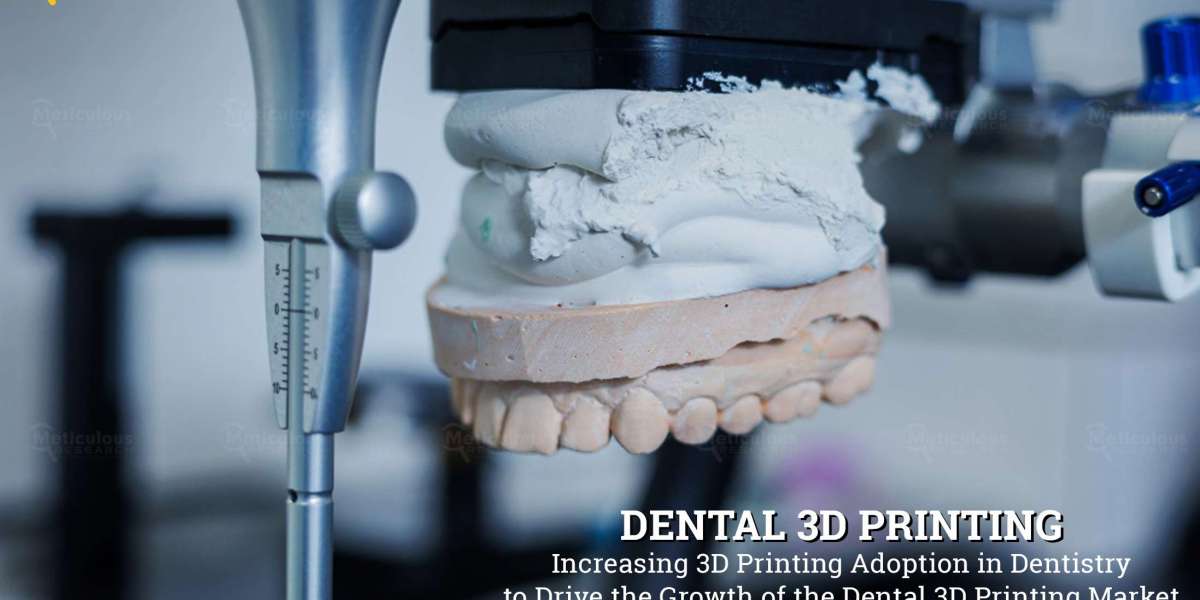 Dental 3D Printing Market to be Worth $13.4 Billion by 2030