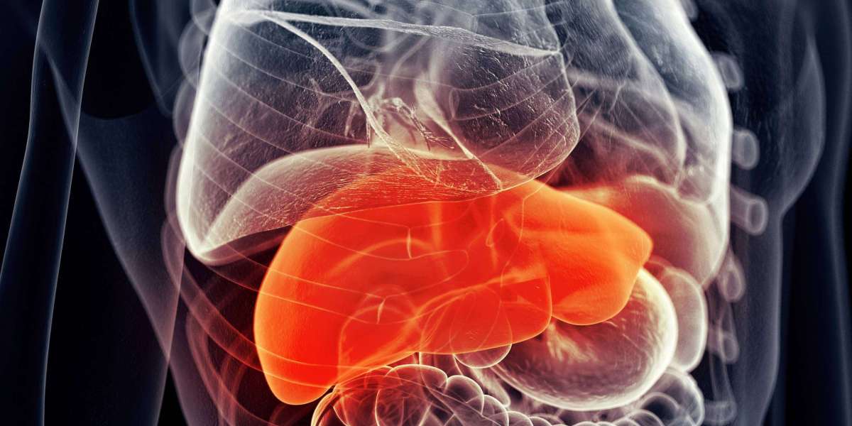 Advanced Liver Cancer Market Size, 2024 Analysis, Industry Trends and Forecasts to 2034