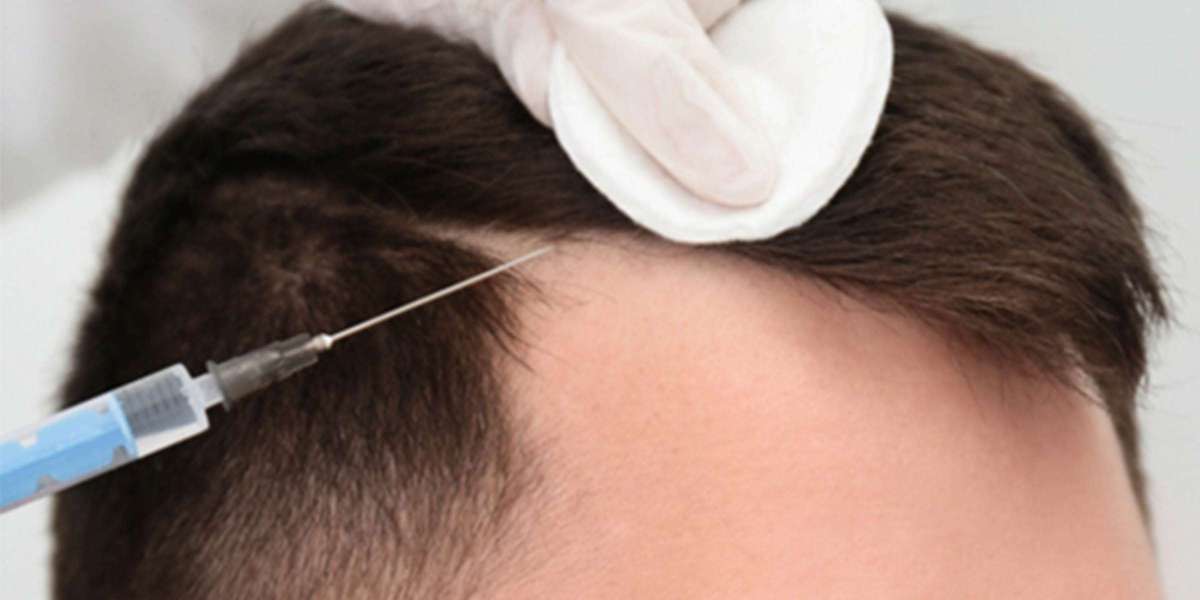 Say Goodbye to Hair Fall: Leading Treatments in Dubai