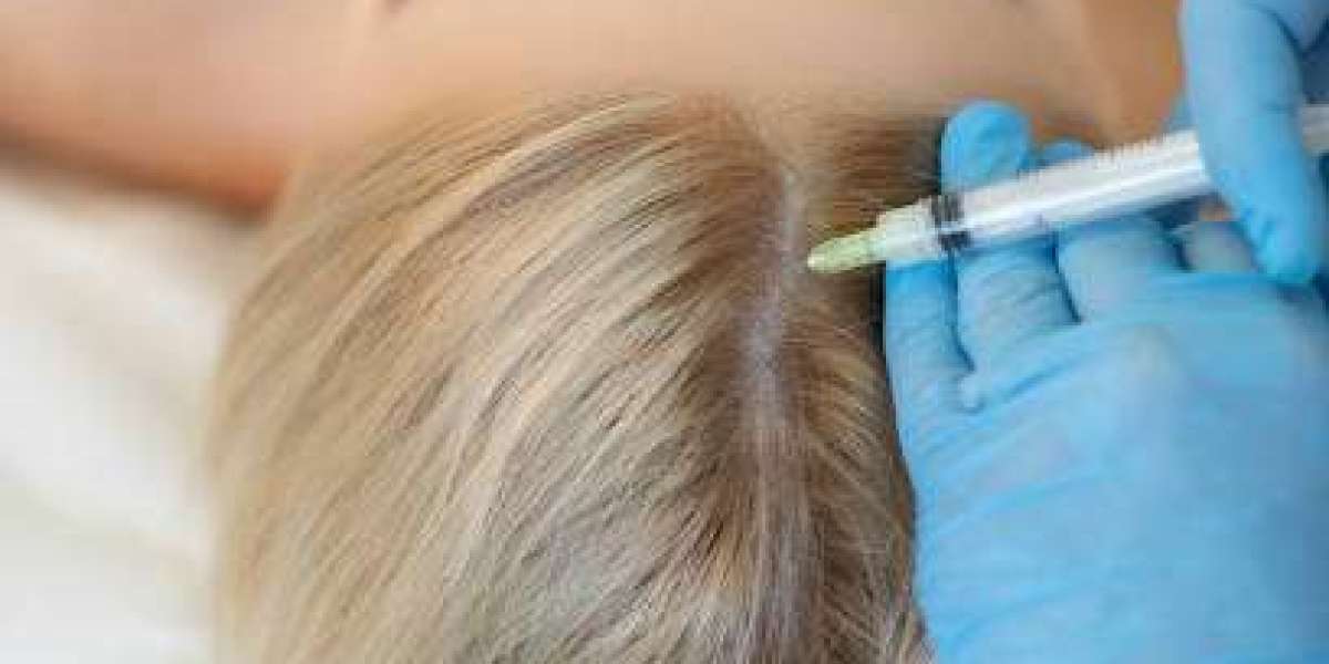 Say Goodbye to Hair Thinning: PRP Treatment
