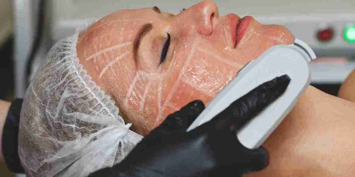 Experience Skin Rejuvenation: Discovering HIFU Treatment in Singapore