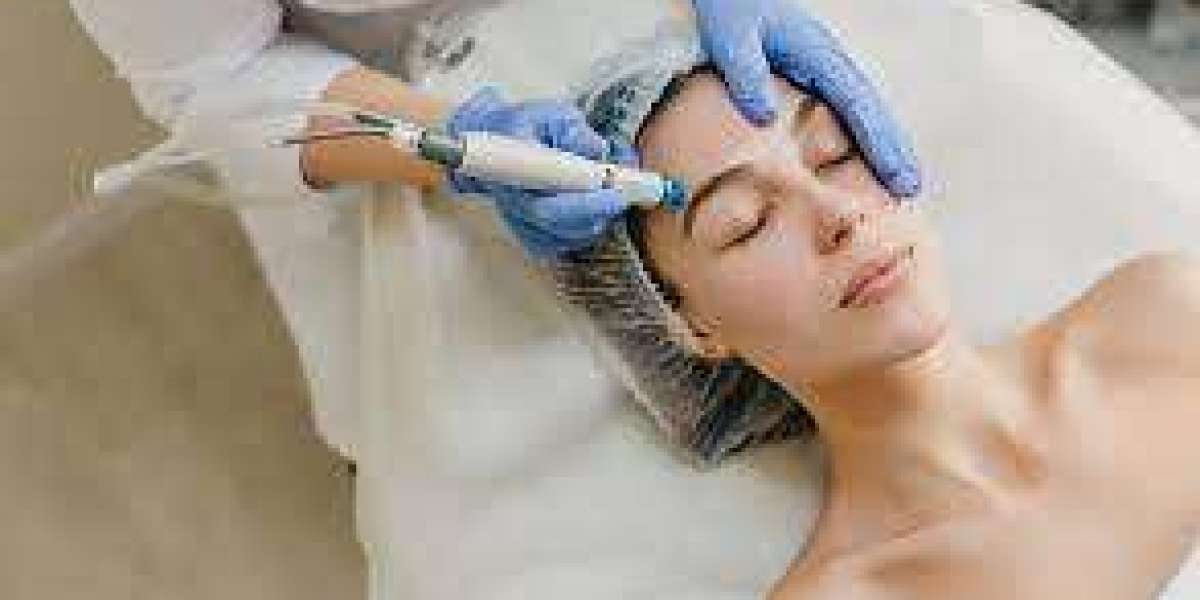 Redefining Beauty: The Investment in Hair Transplantation in Riyadh