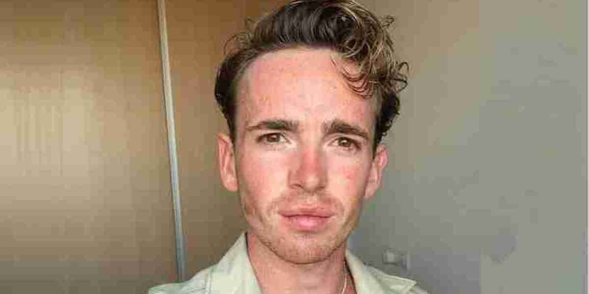 Laurie Kynaston Lips: What Happened After His Cleft Lip Surgery?
