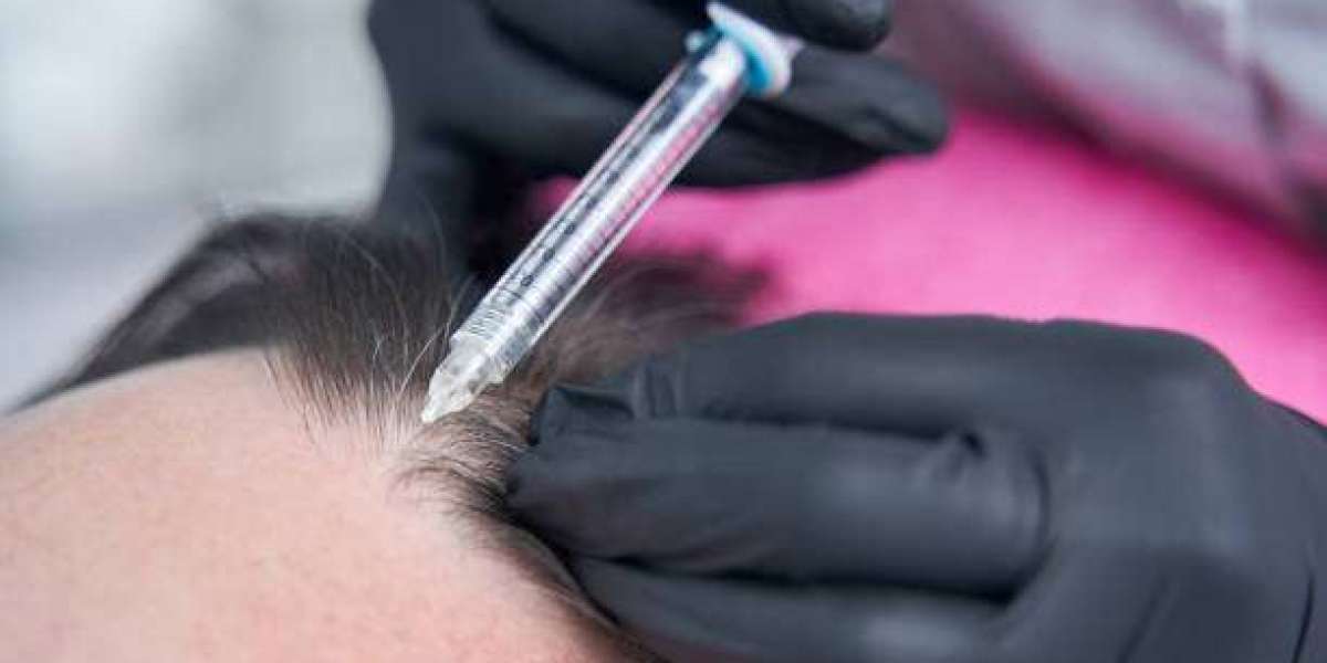 Choosing the Best Scalp Micropigmentation Clinic in Abu Dhabi: Tips and Considerations