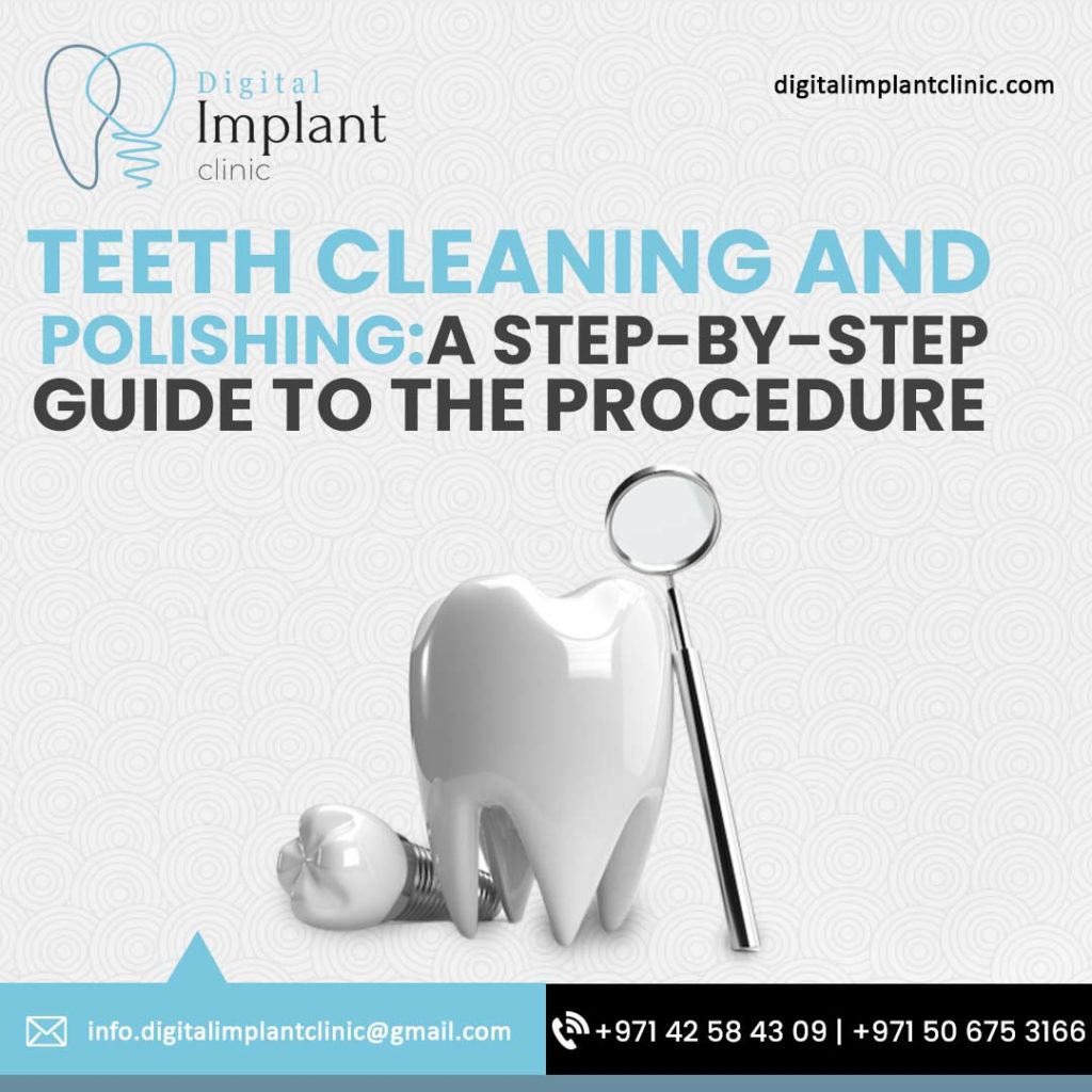 Teeth-cleaning-and-polishing-a-step-by-step-guide-to-the-procedure