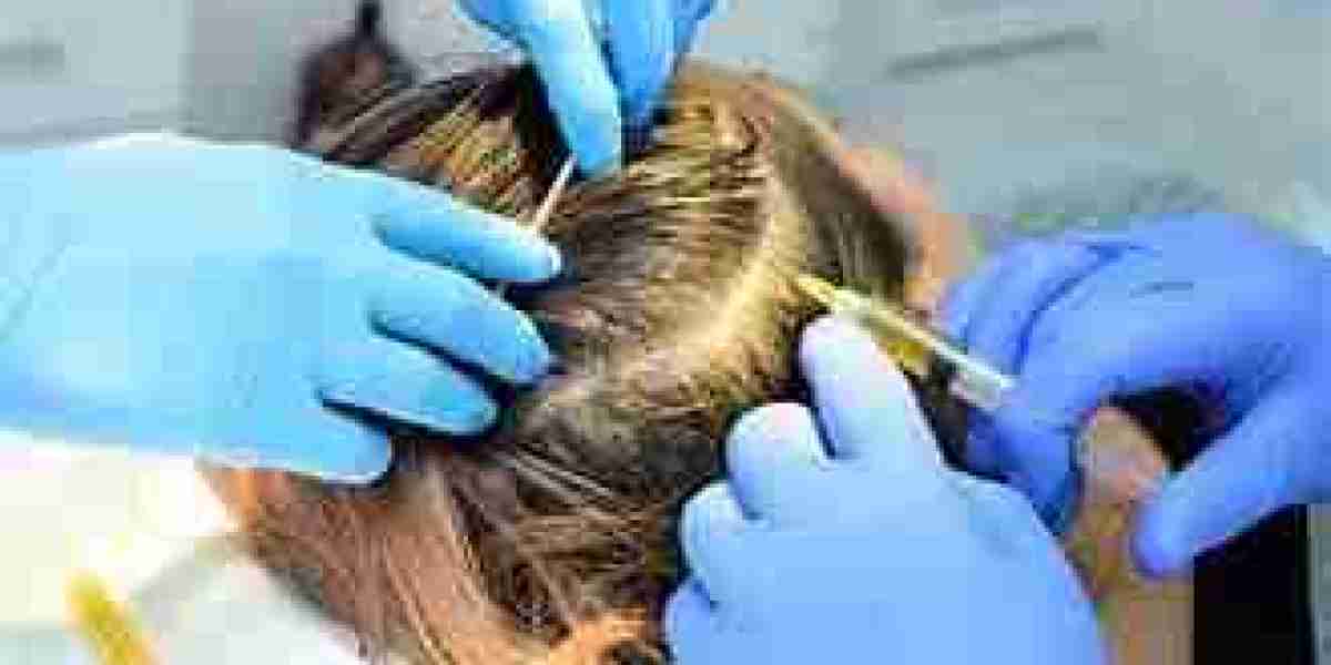 Unlocking Confidence: PRP Hair Treatment in Riyadh