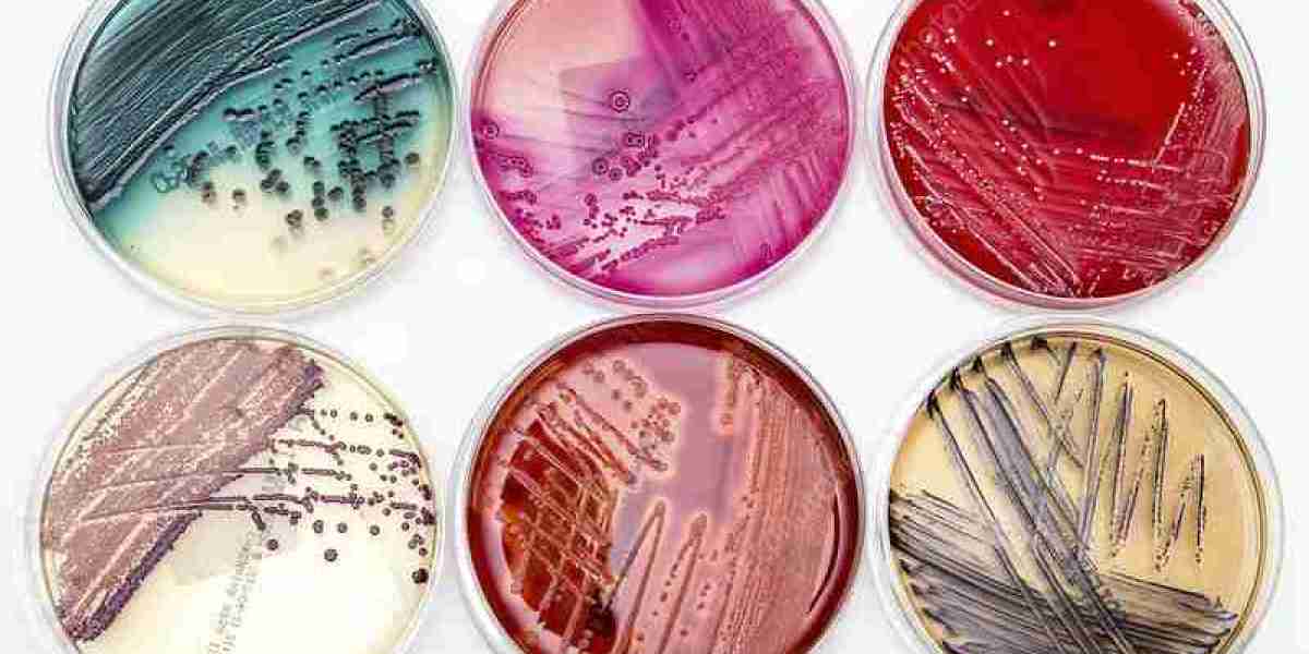 Bacterial Cell Culture Market 2023: Global Forecast to 2032