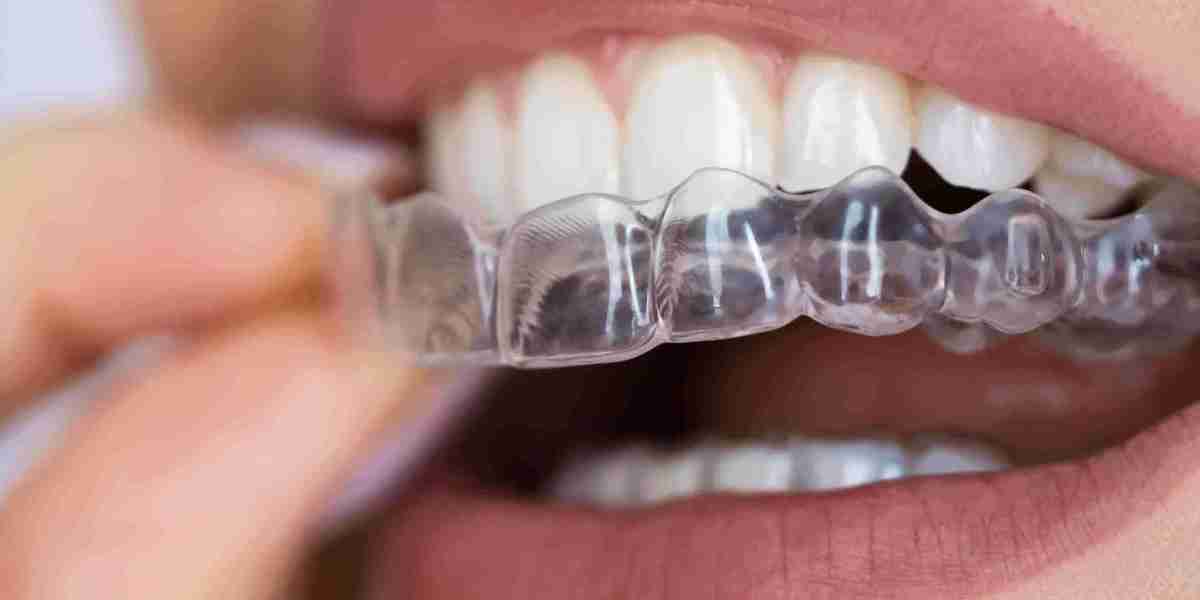 Smile Confidently: Clear Aligners Revolutionize Orthodontic Treatment in Dubai