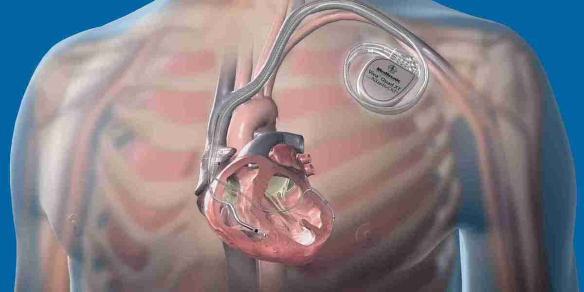 Implantable Neurostimulation Devices Market Opportunities, And Strategy Forecast by 2031
