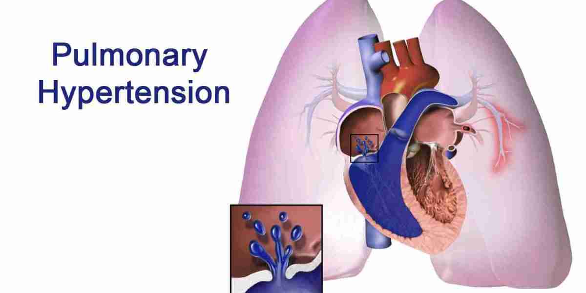 Pulmonary Arterial Hypertension Market  Analysis, Opportunities,