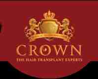 Crown Hair Transplant Experts