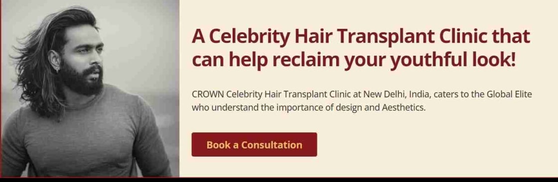 Crown Hair Transplant Experts