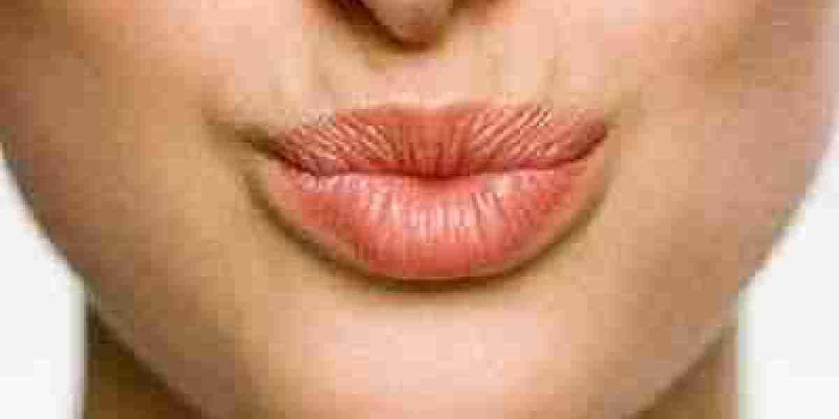 Pucker Up with Confidence: Fast Ways to Lighten Smoker's Lips