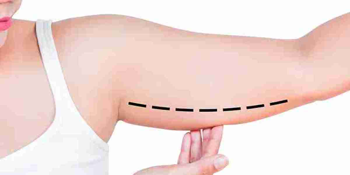 How to Choose the Best Surgeon for Arm Lift Brachioplasty in Dubai