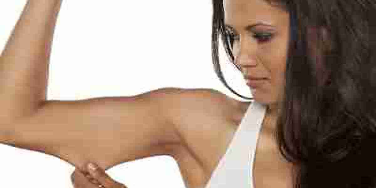 The Top 5 Treatments Offering Non-Surgical Arm Fat Removal in Dubai