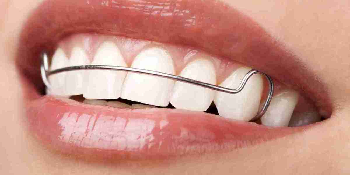 Tips for Adjusting to New Dental Retainers in Dubai