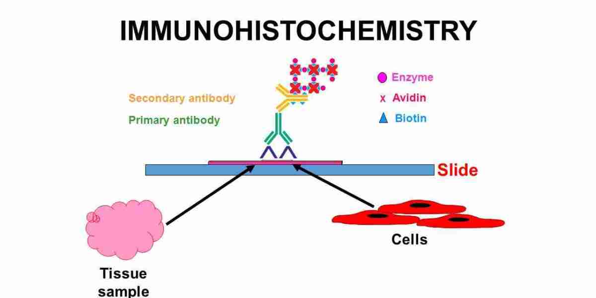 Immunohistochemistry Market Analysis By Opportunities, Size, Share, Growth and Forecast 2028