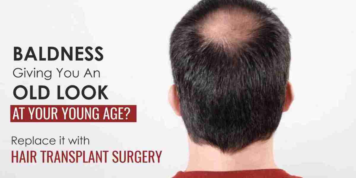 Transform Your Look: Hair Transplant in Punjab with Dr. Vikas Gawri