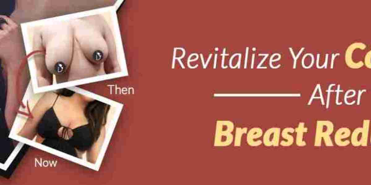 The Ultimate Guide to Recovery After Breast Reduction Surgery