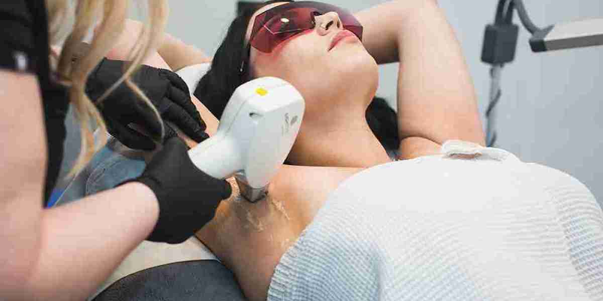 Laser Hair Removal: The Ultimate Guide to Smooth Skin