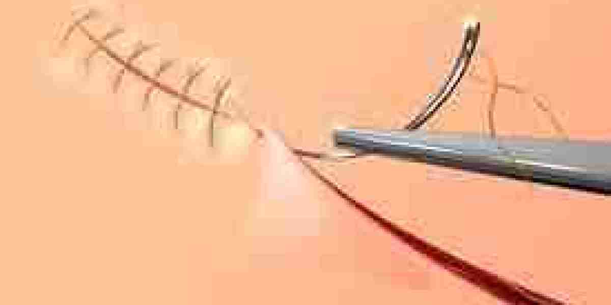 Surgical Sutures Market To Witness Huge Growth By 2032
